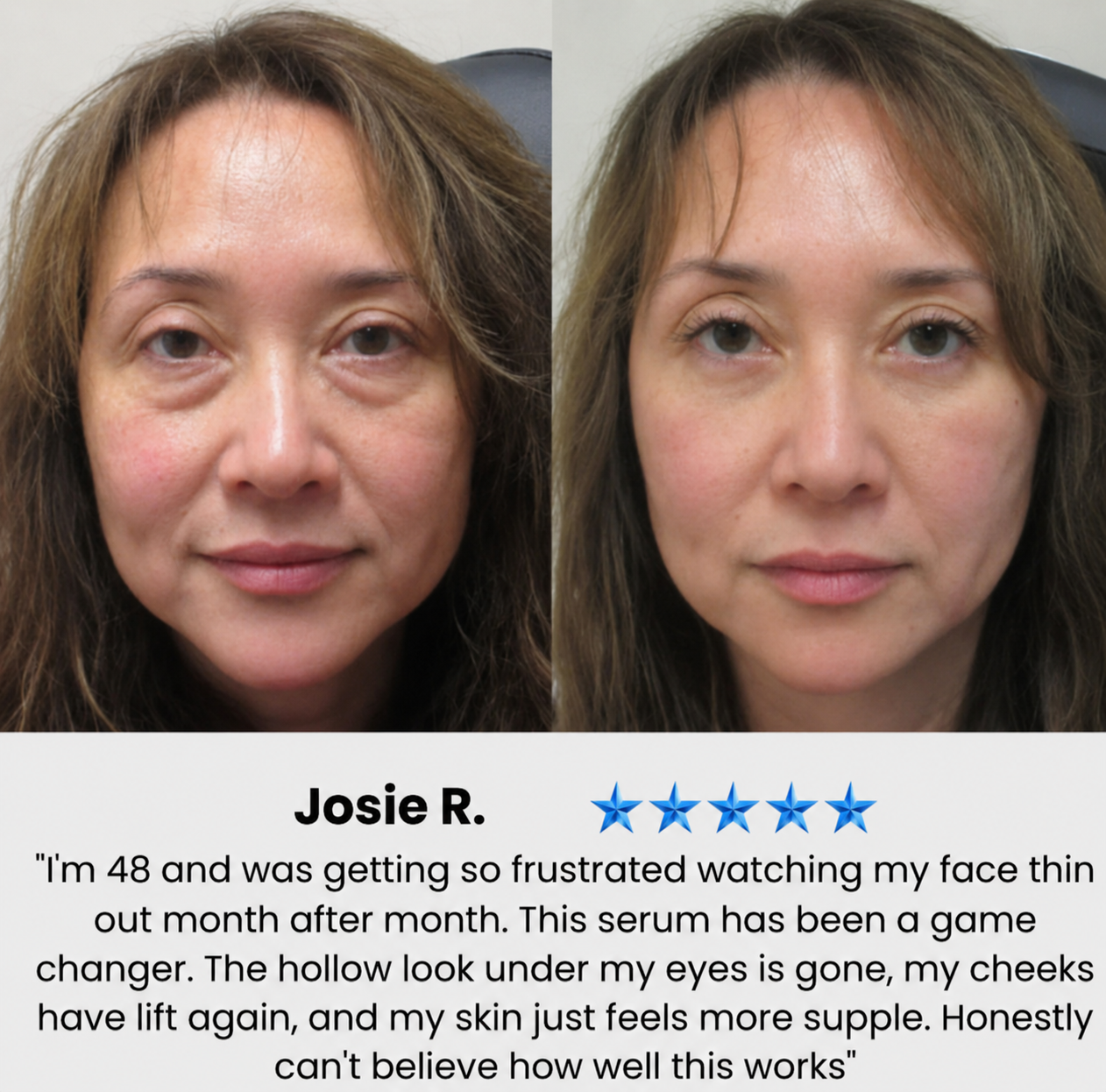 Volufiline 92% + Pal-Isoleucine 1%