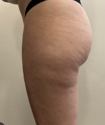 Week 1