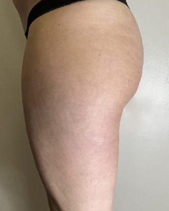 Week 8