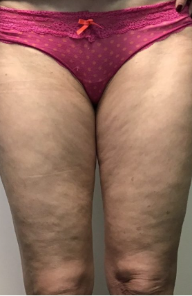 Week 1