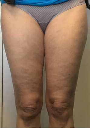 Week 10