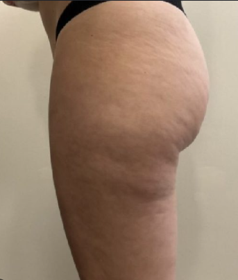 Week 1
