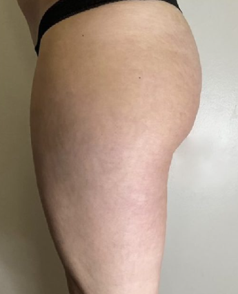 Week 9