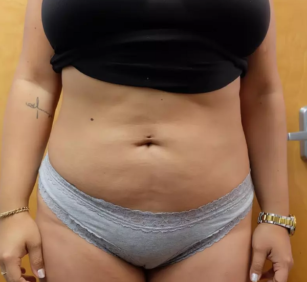 Week 1