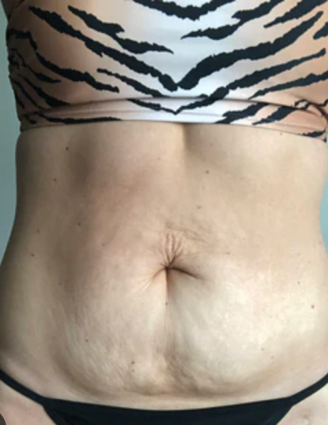 Week 1