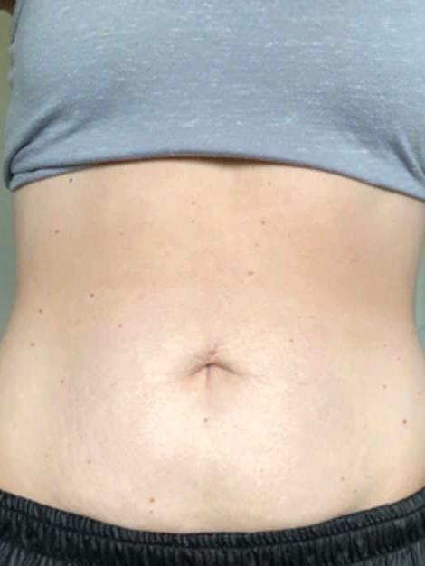 Week 15
