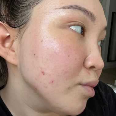Week 1