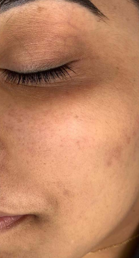 Week 1