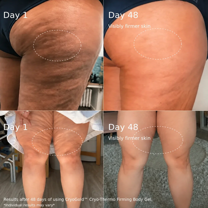 CryoGold™ Cryo-Thermo Firming Body Gel | 200g