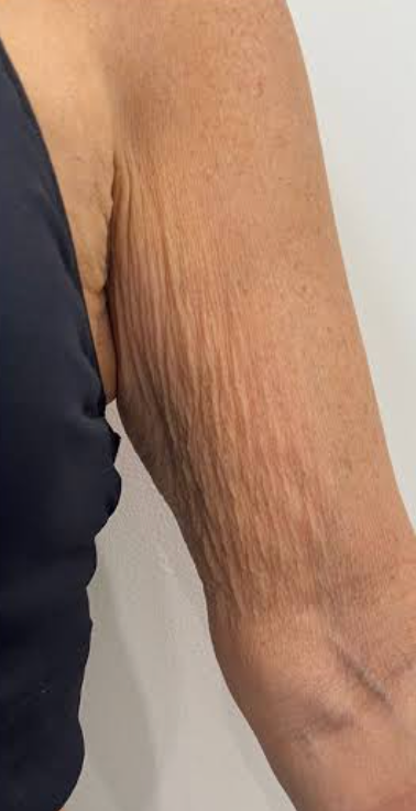Day 1