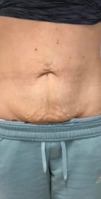 Day 1