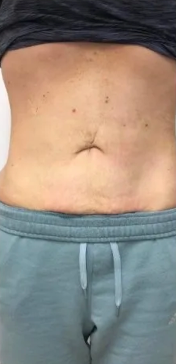 Day 42